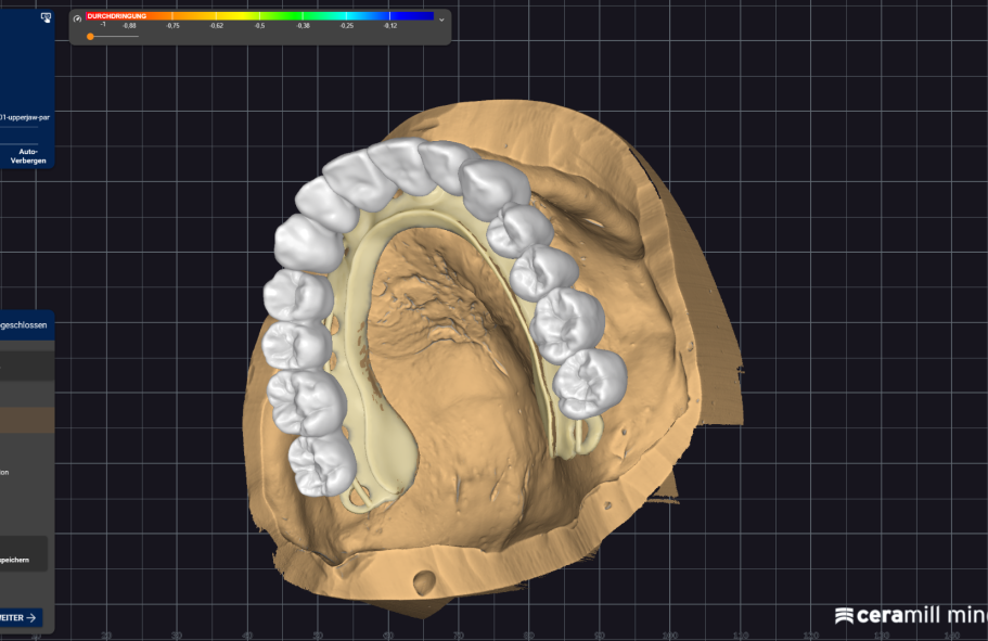 3D-Modell eines Zahnbogens mit weißen Zähnen und einer beige-farbenen Basis.